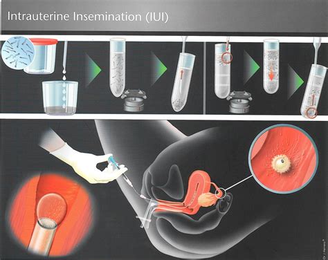 insemination porn